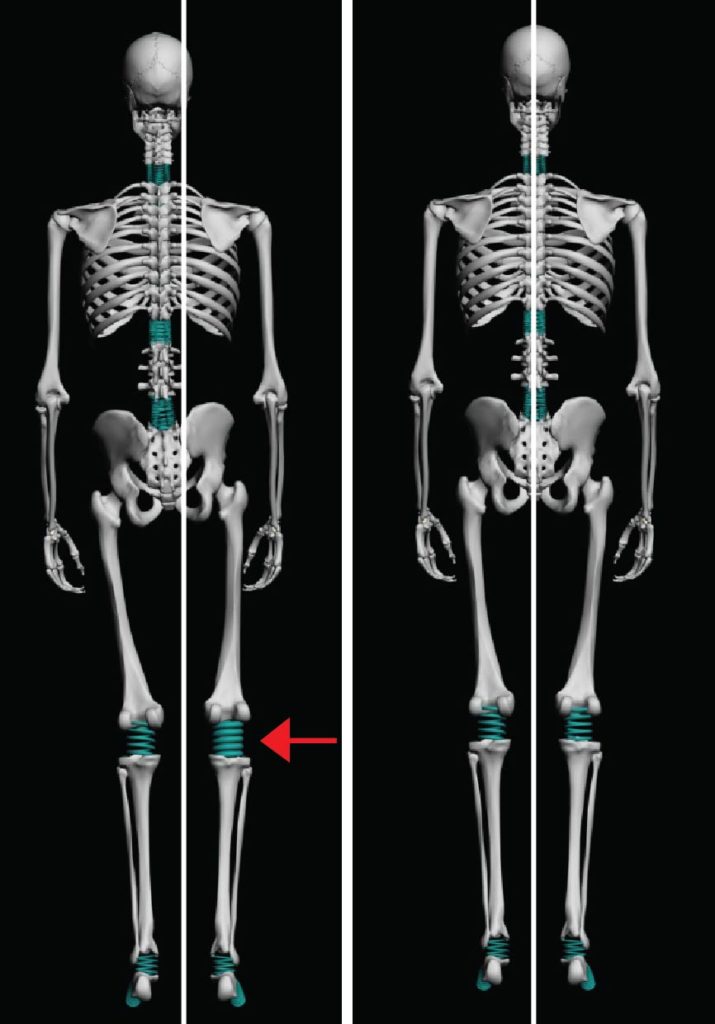 analyse fil à plomb osteopathe